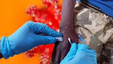 أفريقيا تسجل أكثر من 122 ألف حالة إصابة و1730 حالة وفاة بسبب MPOX منذ 2024 5 1.730 muertes por mpox desde 2024 أفريقيا تسجل أكثر من 122 ألف حالة إصابة و1730 حالة وفاة بسبب MPOX منذ 2024